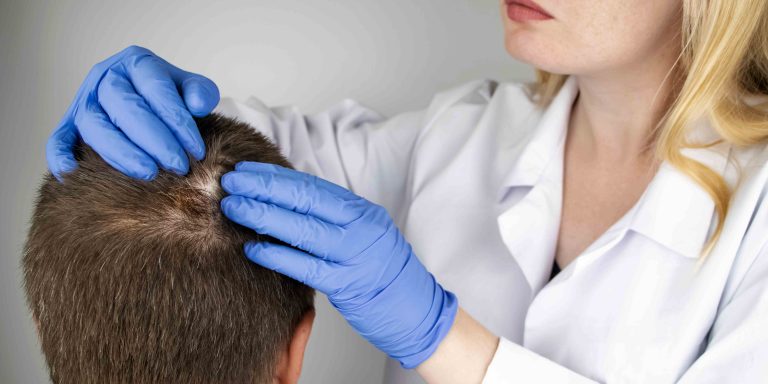 Dermatologist for Hair Loss