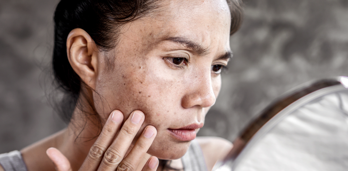 A woman with her hand on her face.