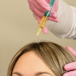 Hair Loss Dermatology Near Largo