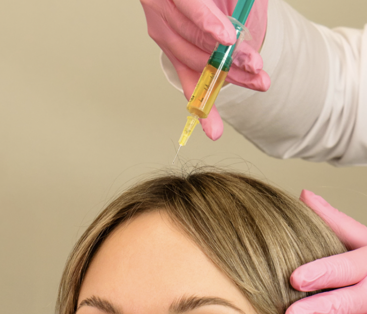 A woman getting her hair colored with a yellow syringe.